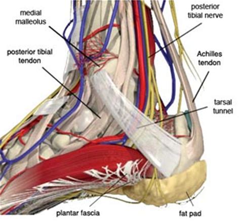 Tarsal Tunnel Syndrome 